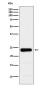 GST3 / GST pi Rabbit mAb ABZ5195