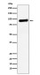 RRM1 Rabbit mAb ABZ5196