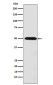 Monocarboxylic Acid Transporter 1 Rabbit mAb ABZ5197