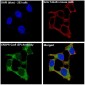CRISPR Cas9 SP Rabbit mAb ABZ5216