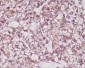 MMP3 Rabbit mAb ABZ5218