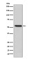 MMP3 Rabbit mAb ABZ5218