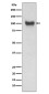 VCAM1 Rabbit mAb ABZ5219