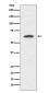 Cytokeratin 9 Rabbit mAb ABZ5221
