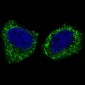 IKK beta Rabbit mAb ABZ5222