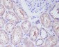 IKK beta Rabbit mAb ABZ5222