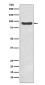 IKK beta Rabbit mAb ABZ5222