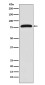 Transglutaminase 2 Rabbit mAb ABZ5224
