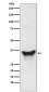 BNIP3L Rabbit mAb ABZ5225