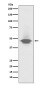 CD79a Rabbit mAb ABZ5228