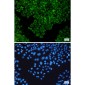 TNF Receptor 2 Rabbit mAb ABZ5230