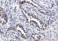 TNF Receptor 2 Rabbit mAb ABZ5230
