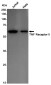 TNF Receptor 2 Rabbit mAb ABZ5230