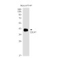 CD147 Rabbit mAb ABZ5231