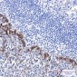 Hsp70 Rabbit mAb ABZ5233