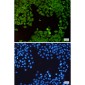 PSMD14 Rabbit mAb ABZ5235