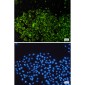 NSE Rabbit mAb ABZ5236