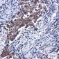 NSE Rabbit mAb ABZ5236