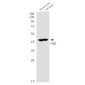 NSE Rabbit mAb ABZ5236