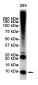 Ubiquitin Rabbit mAb ABZ5237