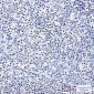 IKZF3 Rabbit mAb ABZ5238