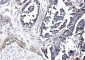 Integrin beta 1 Rabbit mAb ABZ5239