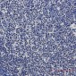 PARP1 Rabbit mAb ABZ5240