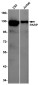 PARP1 Rabbit mAb ABZ5240