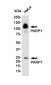 PARP1 Rabbit mAb ABZ5240