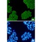 Cytokeratin 8 Rabbit mAb ABZ5242