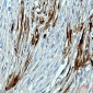 Calbindin Rabbit mAb ABZ5243