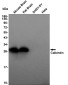 Calbindin Rabbit mAb ABZ5243