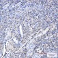 Plastin L Rabbit mAb ABZ5244