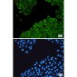 CK18 Rabbit mAb ABZ5245