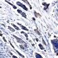 CK18 Rabbit mAb ABZ5245