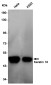 CK18 Rabbit mAb ABZ5245