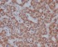 VDAC1/Porin Rabbit mAb ABZ5247