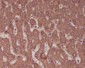 Alkaline Phosphatase Rabbit mAb ABZ5248
