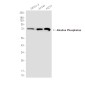 Alkaline Phosphatase Rabbit mAb ABZ5248