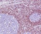 Bcl 2 Rabbit mAb ABZ5249