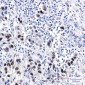 Cyclin D1 Rabbit mAb ABZ5250