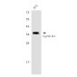 Cyclin D1 Rabbit mAb ABZ5250