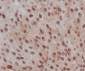 Phospho-Smad2 (Ser255) Rabbit mAb ABZ5260
