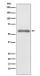 Phospho-Smad2 (Ser255) Rabbit mAb ABZ5260