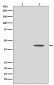 Phospho-MEK1 (Thr292) Rabbit mAb ABZ5262