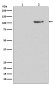 Phospho-Glutamate Receptor 1 (AMPA Subtype) (Ser845) Rabbit mAb ABZ5265