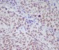 Phospho-STAT1 (Ser727) Rabbit mAb ABZ5266