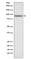 Phospho-STAT1 (Ser727) Rabbit mAb ABZ5266