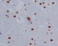 Phospho-STAT3 (Ser727) Rabbit mAb ABZ5267