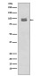 Phospho-STAT3 (Ser727) Rabbit mAb ABZ5267